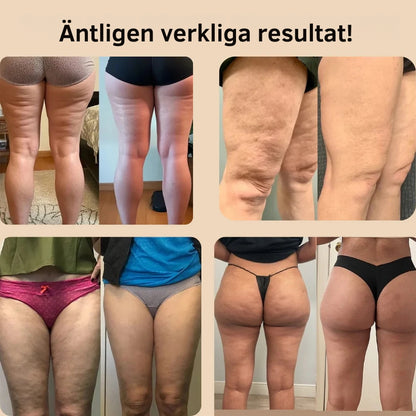 3D Anti-Cellulitleggings