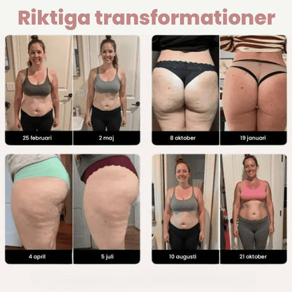 3D Anti-Cellulitleggings